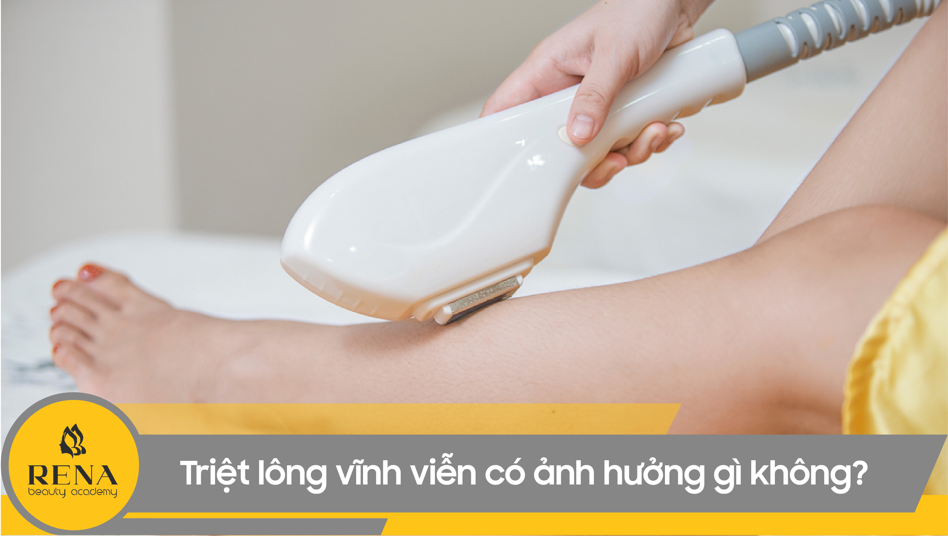 Triệt lông vĩnh viễn có ảnh hưởng gì không? Lưu ý để triệt lông vĩnh viễn an toàn