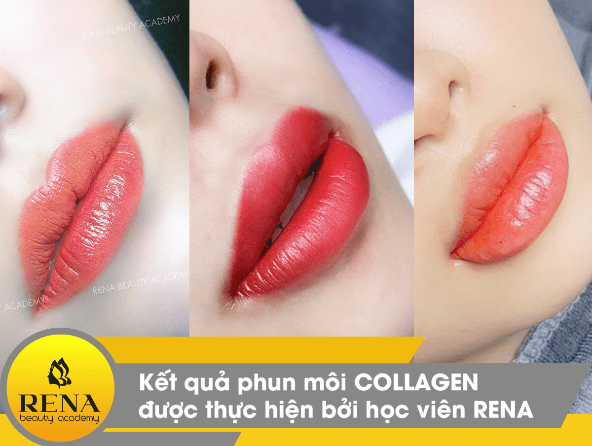 Kết quả phun môi Collagen được thực hiện bởi học viên RENA